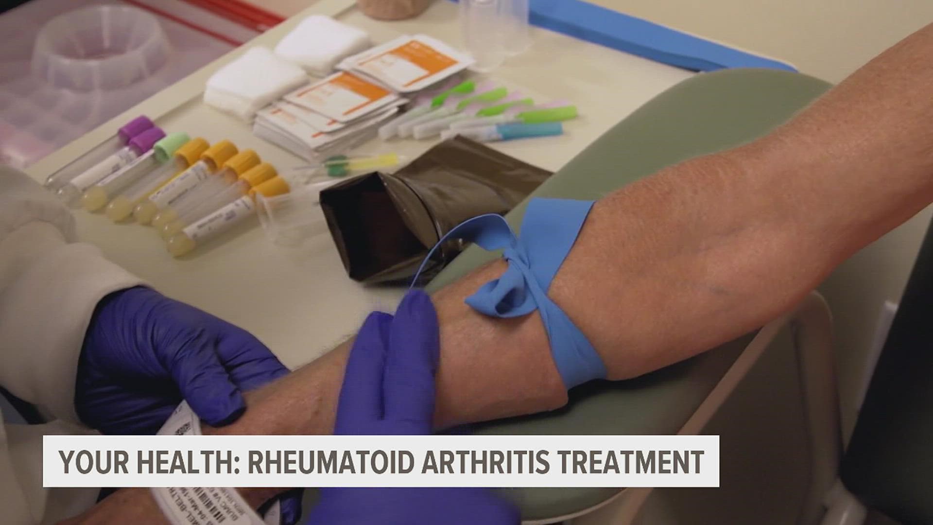 Finding the right therapy for rheumatoid arthritis is often trial and error. But now, a new blood test can take the guesswork out of prescribing medication.