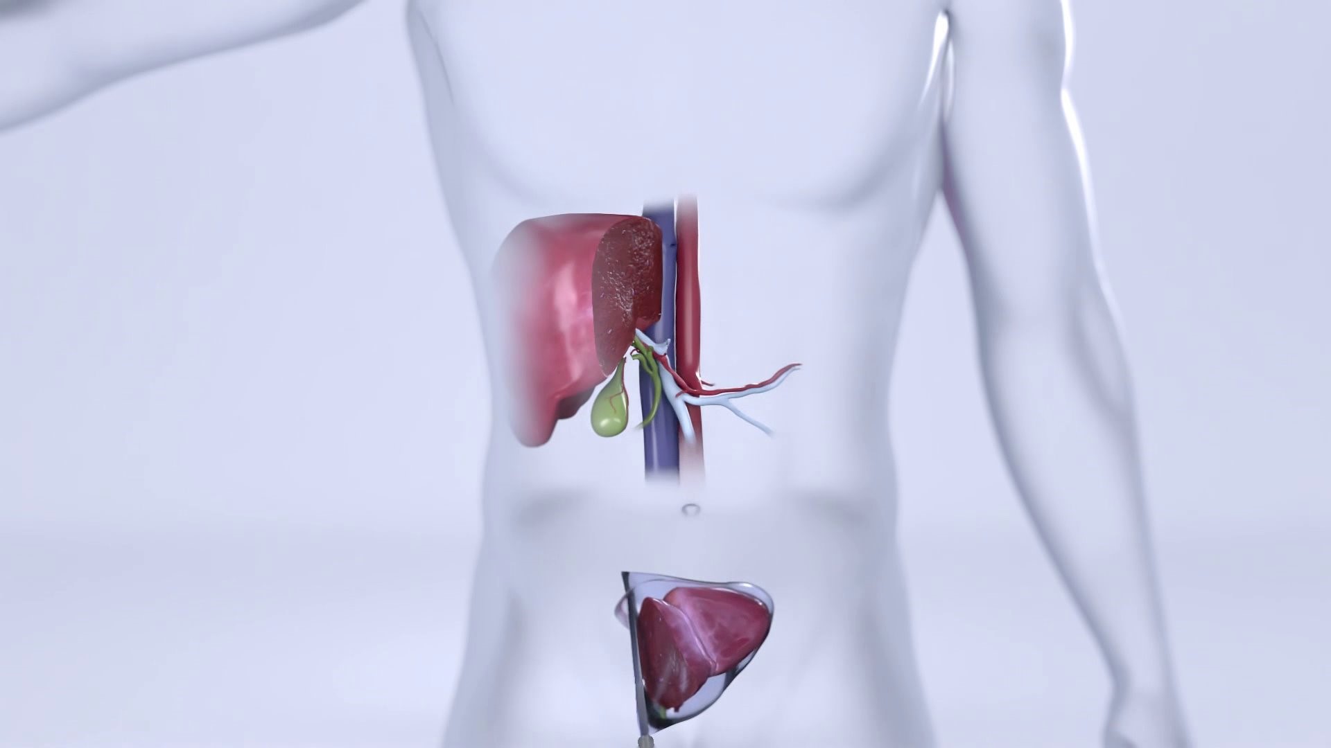 A new, less invasive surgery could mean less time to wait for a transplant
