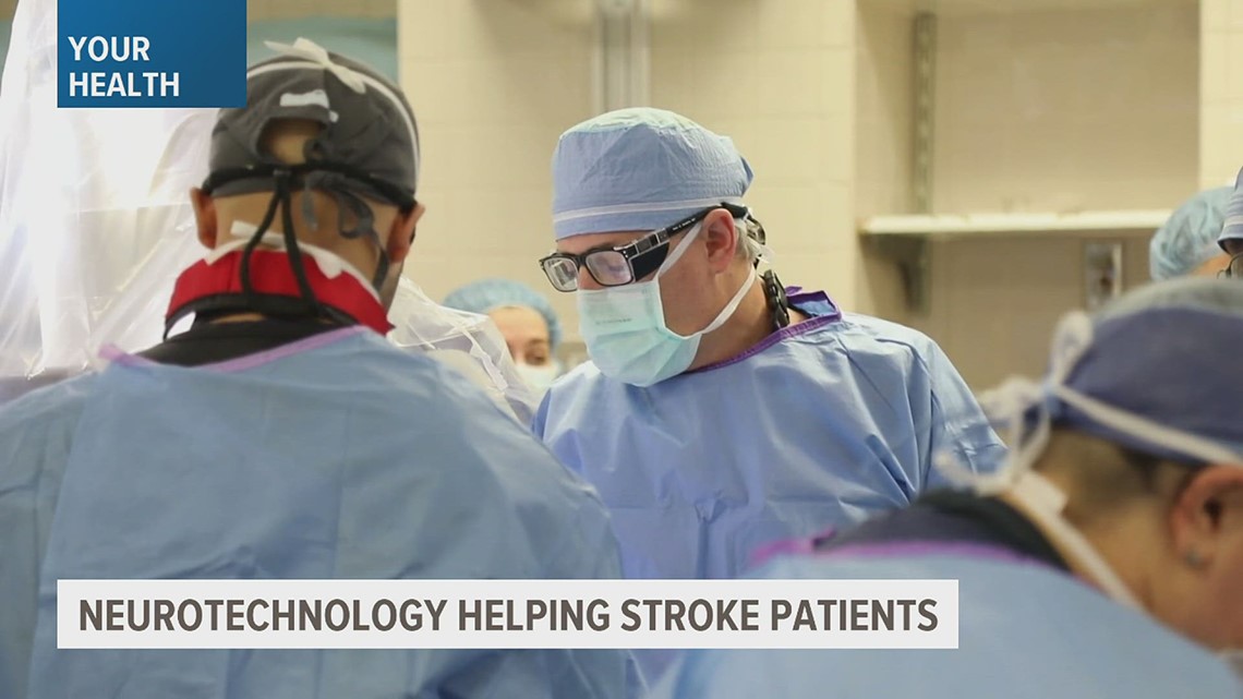 Neurotechnology is giving stroke patients a new lease on life - Vimarsana News