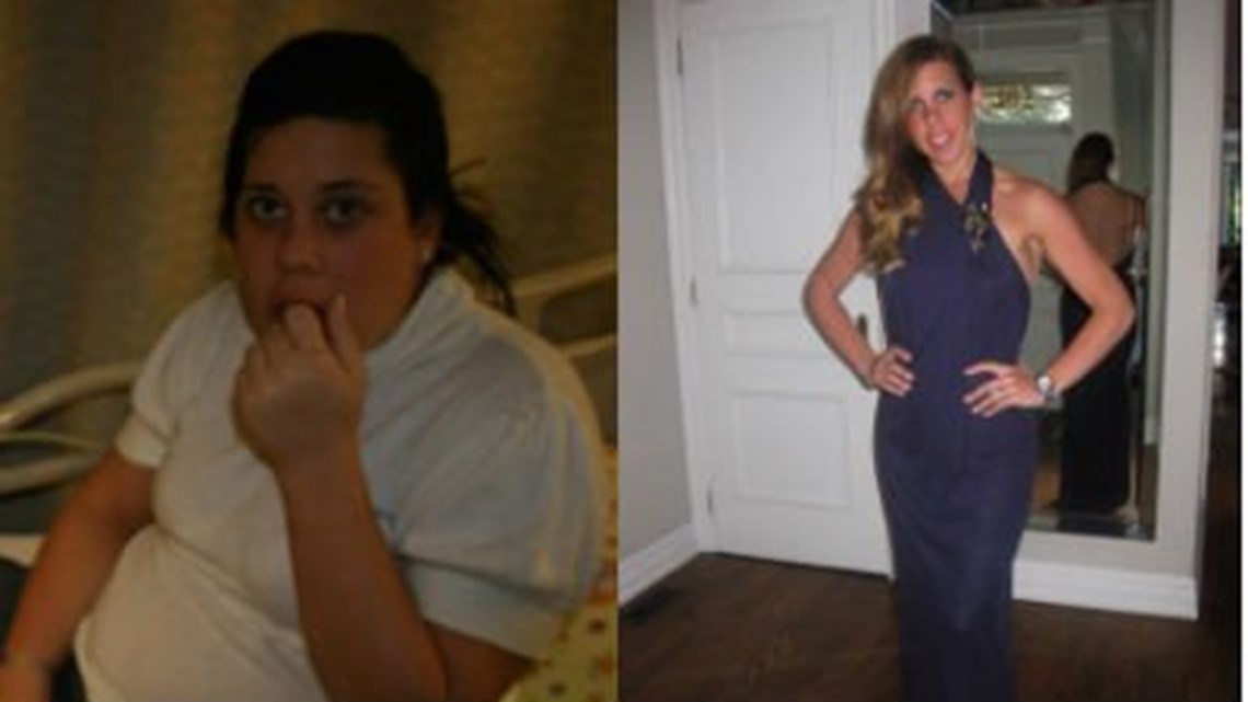 Mother Of Three Loses More Than 100 Pounds Gained During Pregnancy 