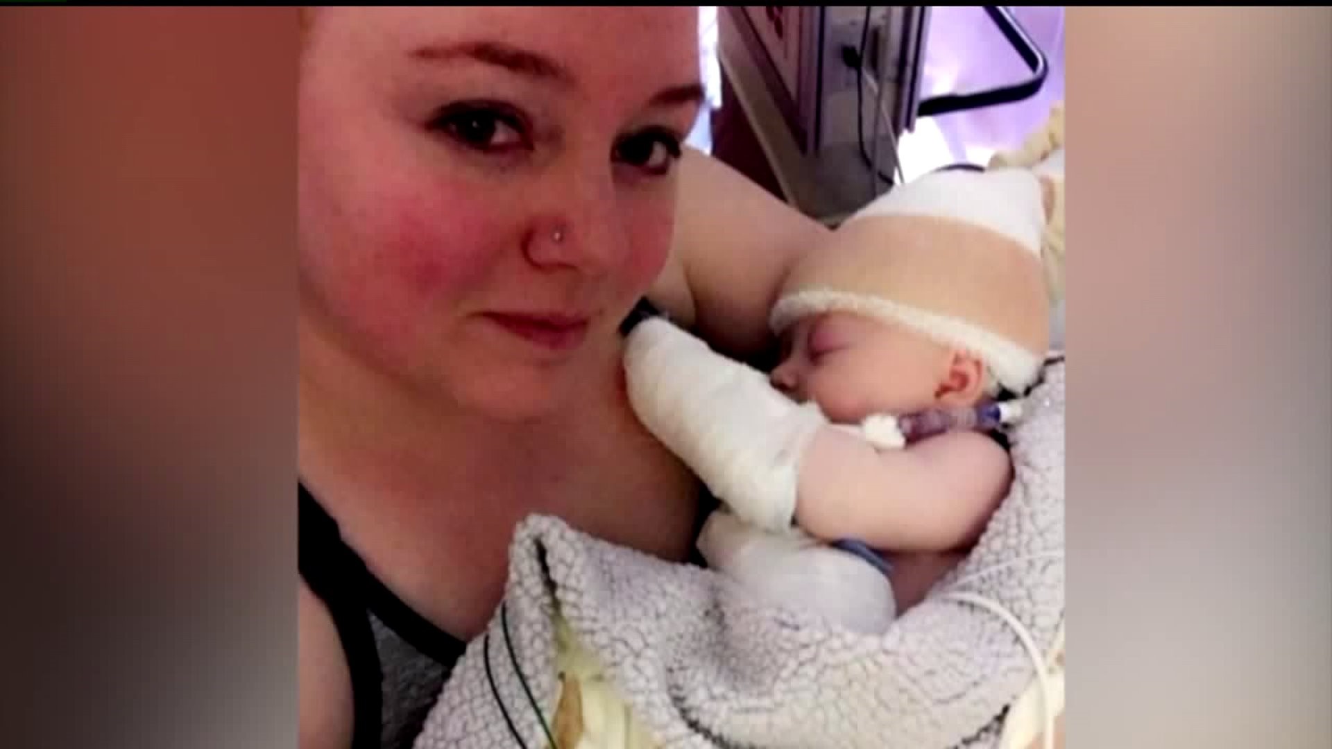 Iowa baby hit by softball slowly recovering