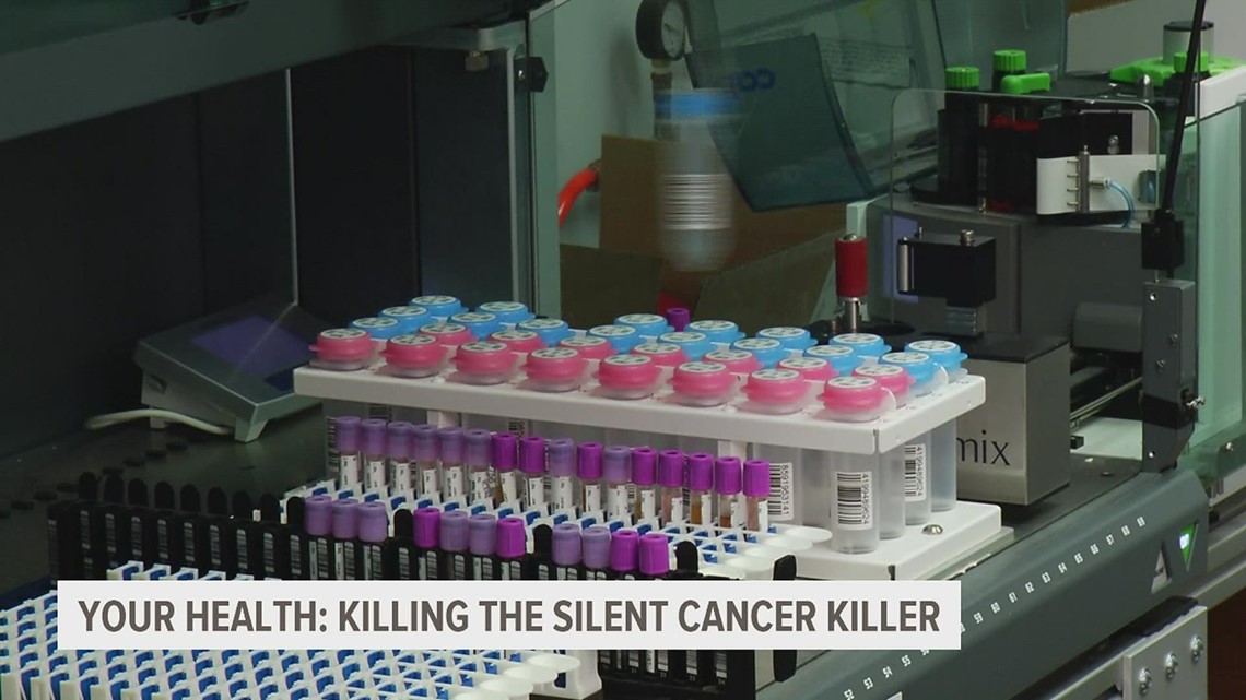 It's been known as the silent killer: ovarian cancer - Vimarsana News