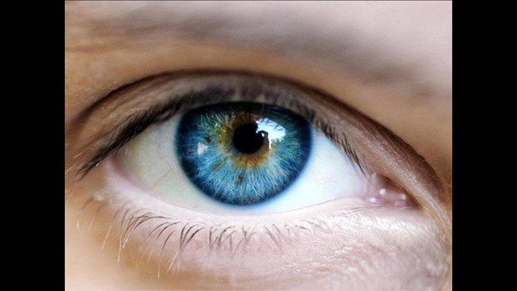 Laser procedure can turn brown eyes to blue