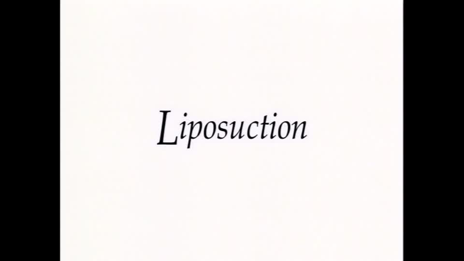 Dr. Eckhardt Liposuction