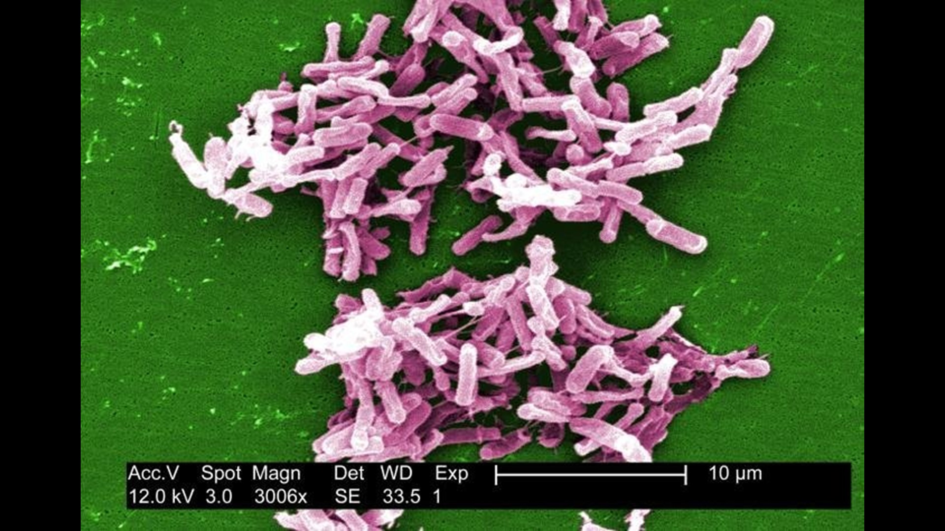 CDC Investigates Deadly Bacteria’s Link To Doctors’ Offices | Wqad.com