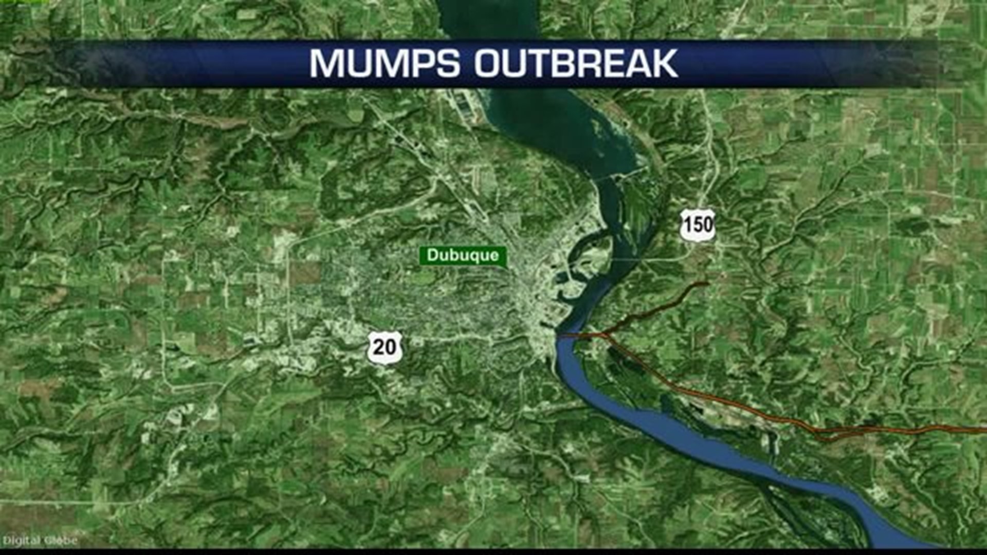 Mumps outbreak