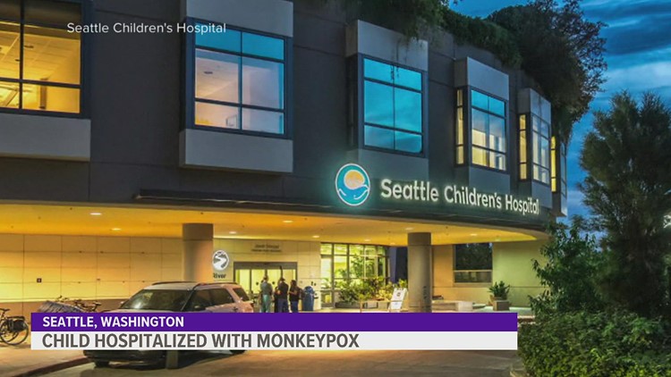 Seattle baby hospitalized with monkeypox after contact with infected family member