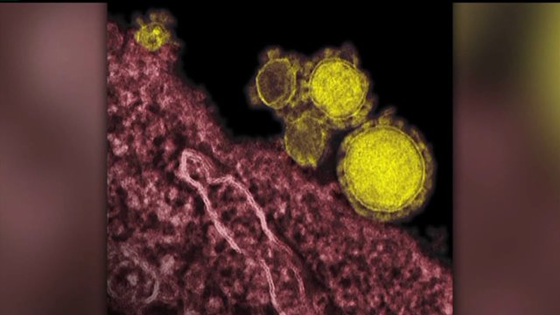 CDC says Illinois patient did not have MERS