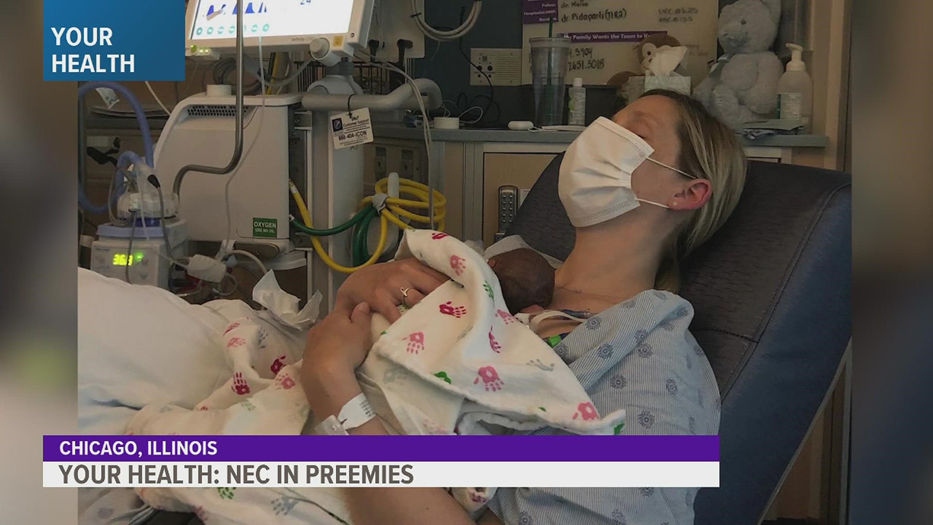 NEC (or necrotizing enterocolitis) causes intestinal tissue to die in preemies. But now, researchers may have found what causes it and how to prevent it.