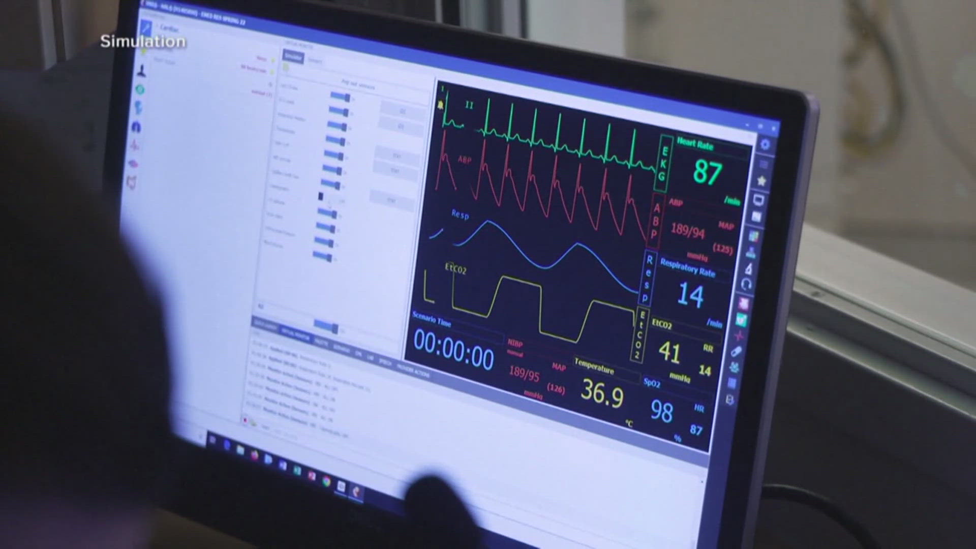 The remote nurses work with bedside staff to monitor patients' vitals, conduct admissions & educate families. Officials say this will help with staffing challenges.