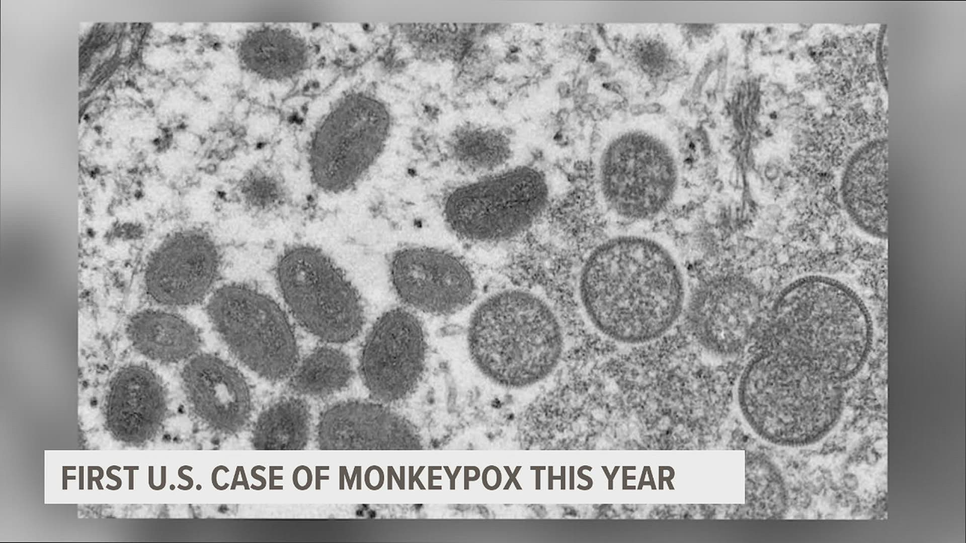 A Massachusetts man has contracted the first case of monkeypox reported in the U.S. this year after he recently traveled to Canada.