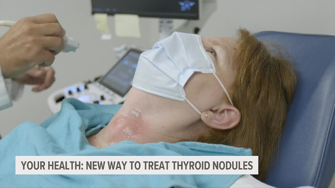 A look at the new noninvasive procedure shrinking thyroid nodules