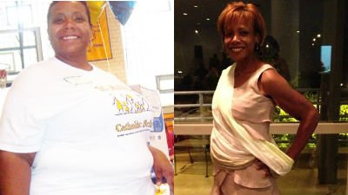 Yoyo dieter shares her journey to lose 177 pounds