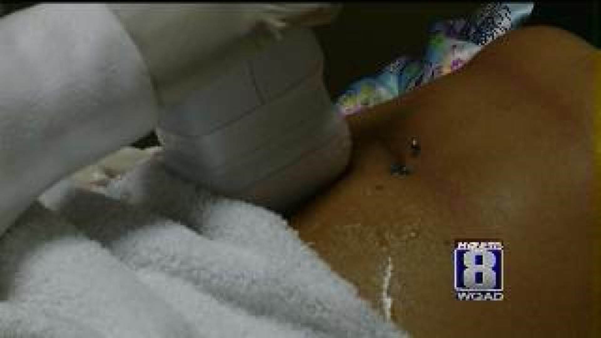 More teens undergoing cosmetic surgery