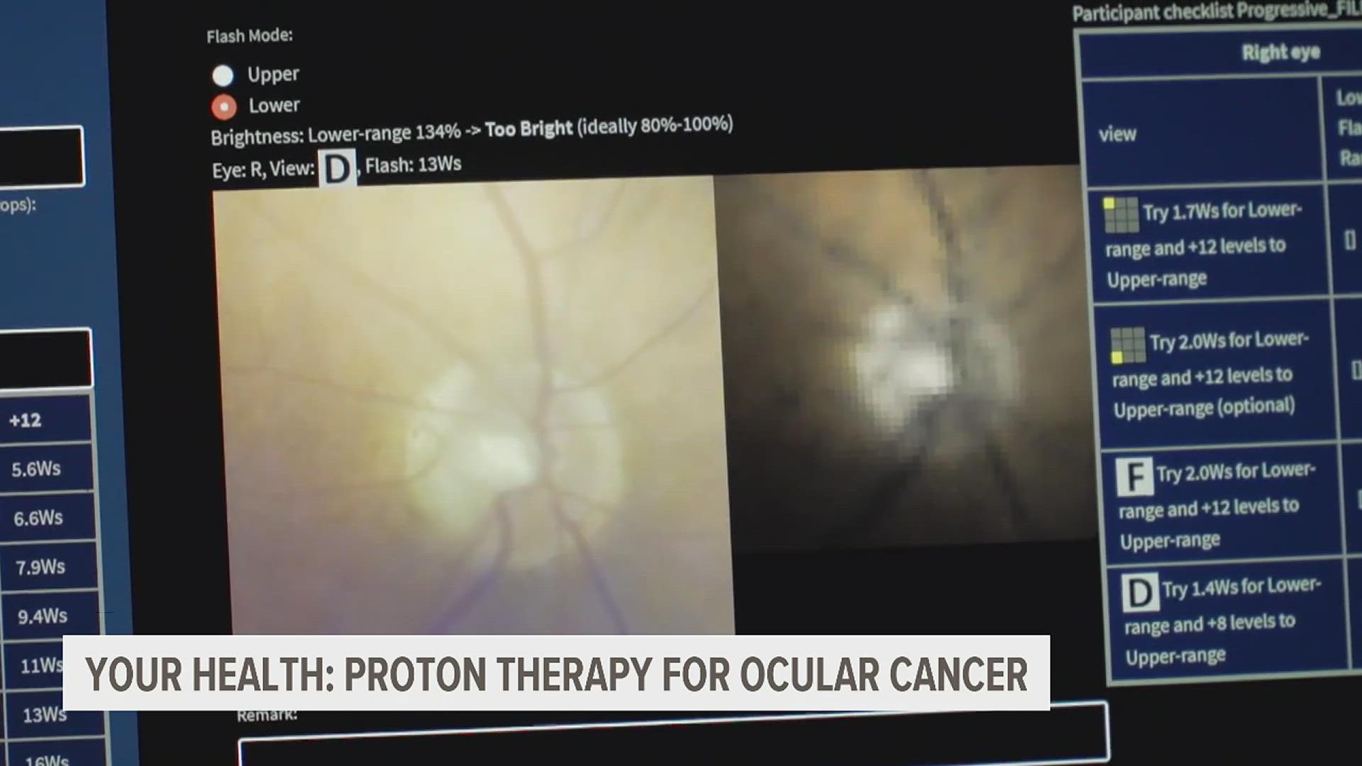 When treated early, proton therapy can cure almost 95% of ocular cancers.