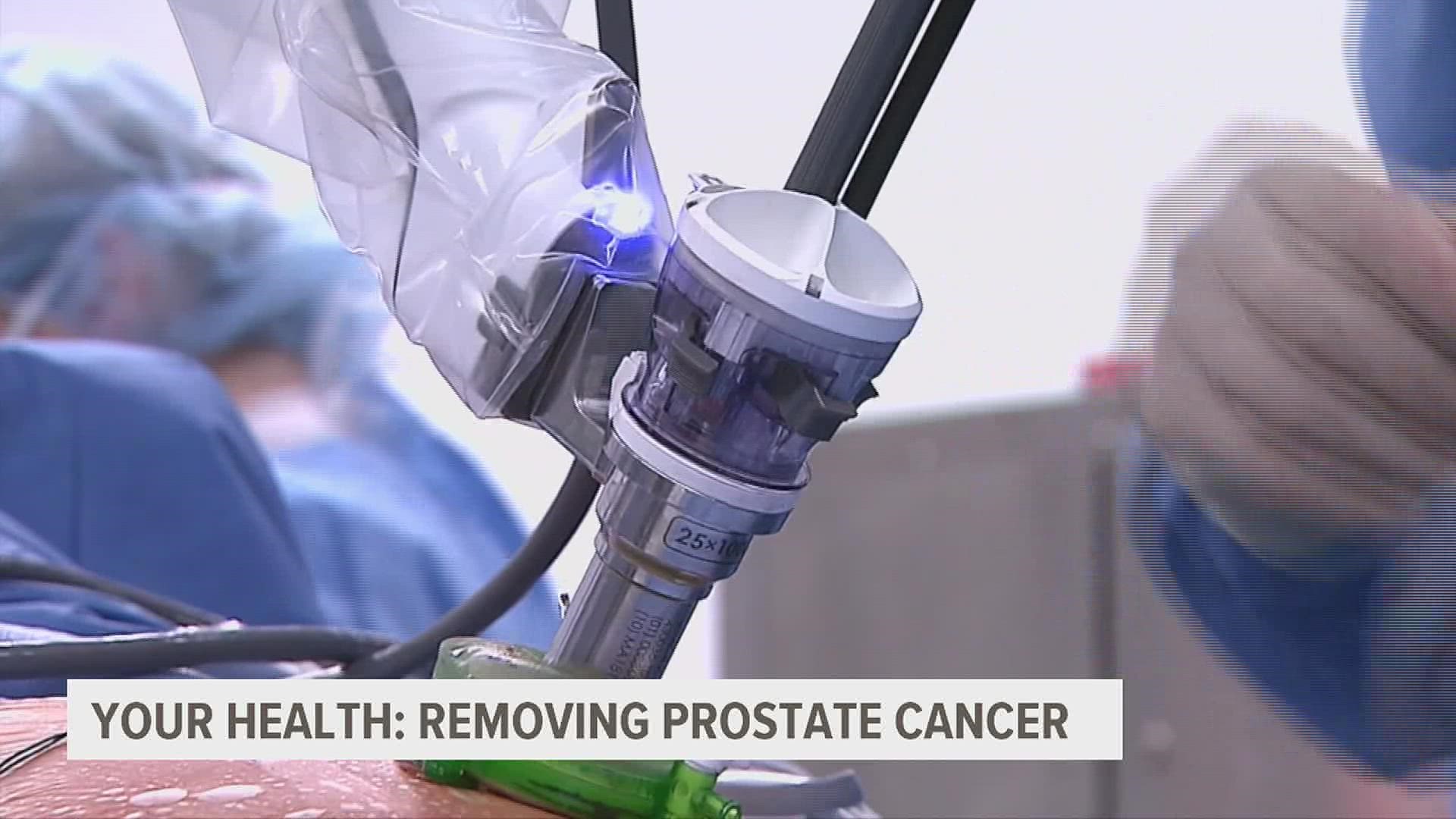 Surgeons are performing a first-of-its-kind surgery – safely removing cancer in the prostate through the bladder.