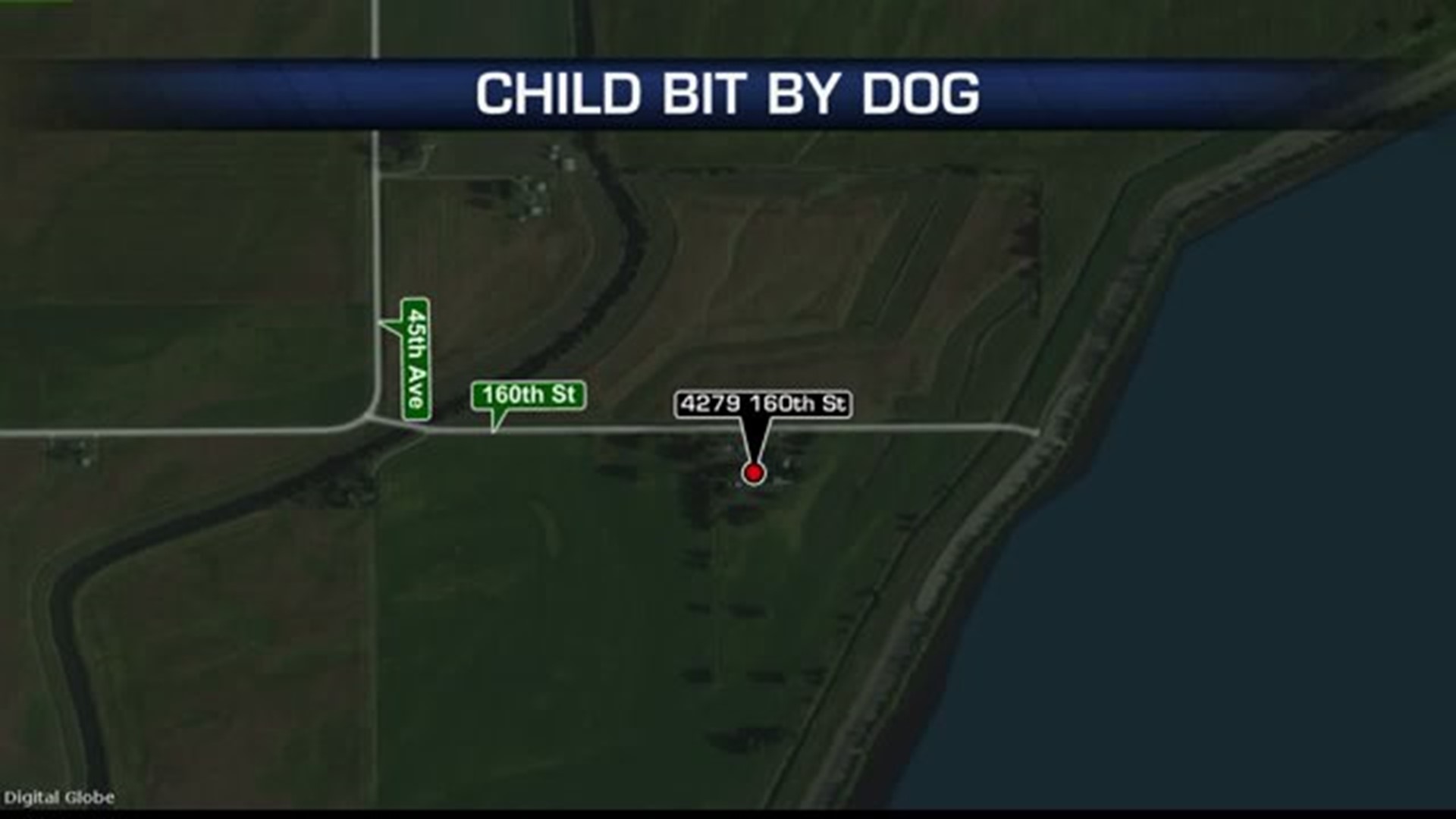 Child suffers dog bite in Burlington