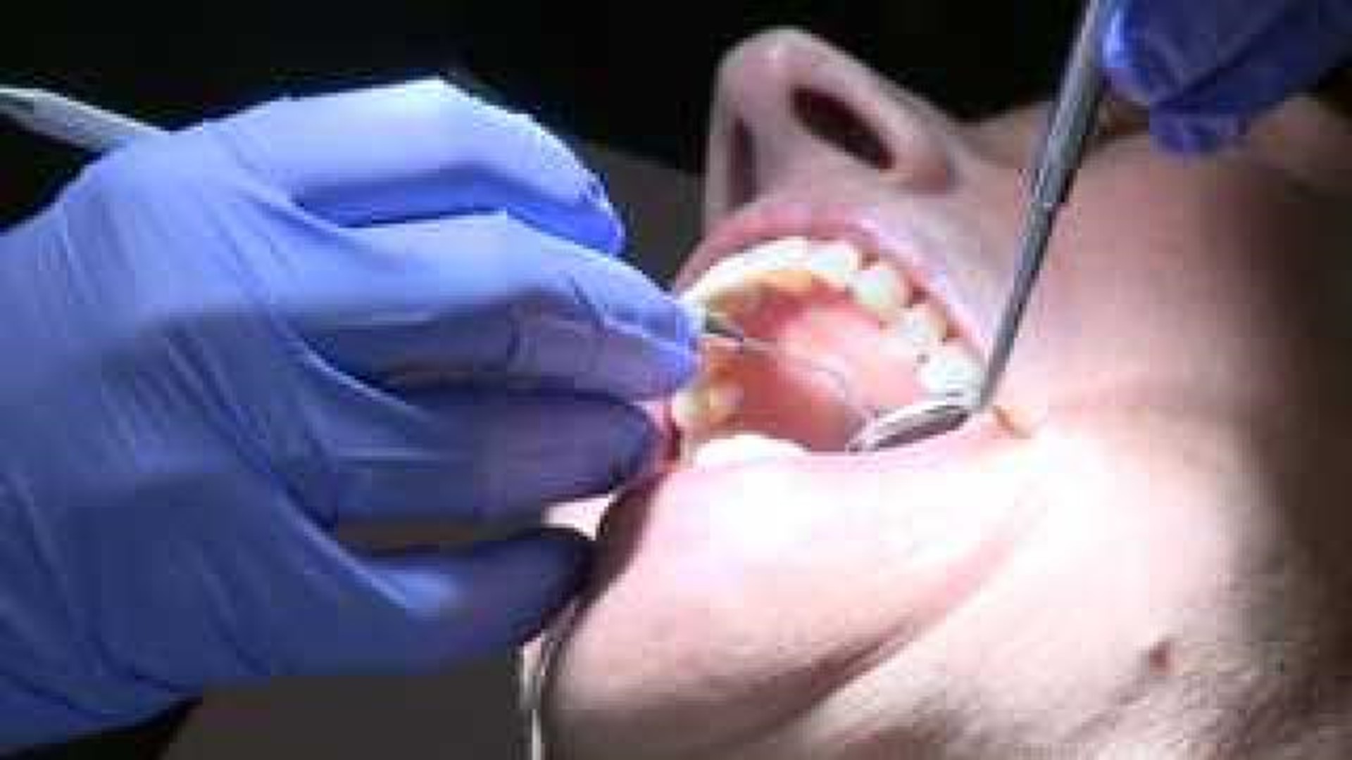 Local dentist talks safety