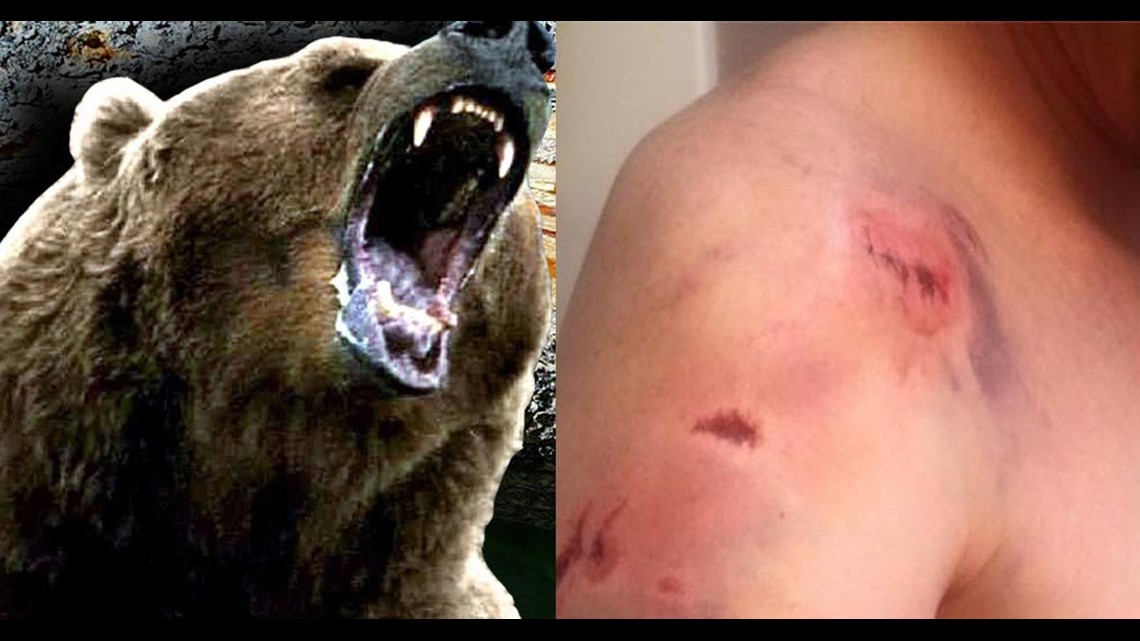 Montana man posts graphic video showing aftermath of grizzly bear
