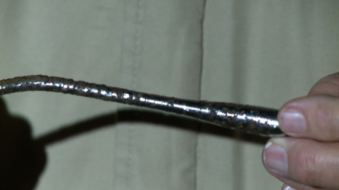 Turn signal lever stuck in Illinois man’s arm for 51 years