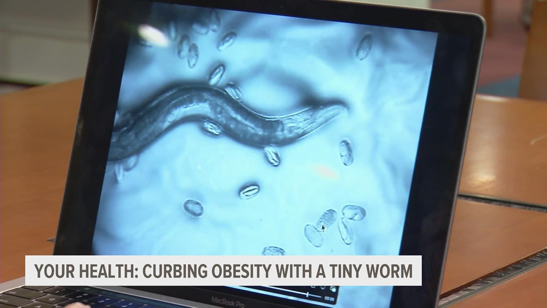 Researchers at the University of Virginia have identified specific genes that may put you at a higher risk of gaining weight. And the key... might be in worms.