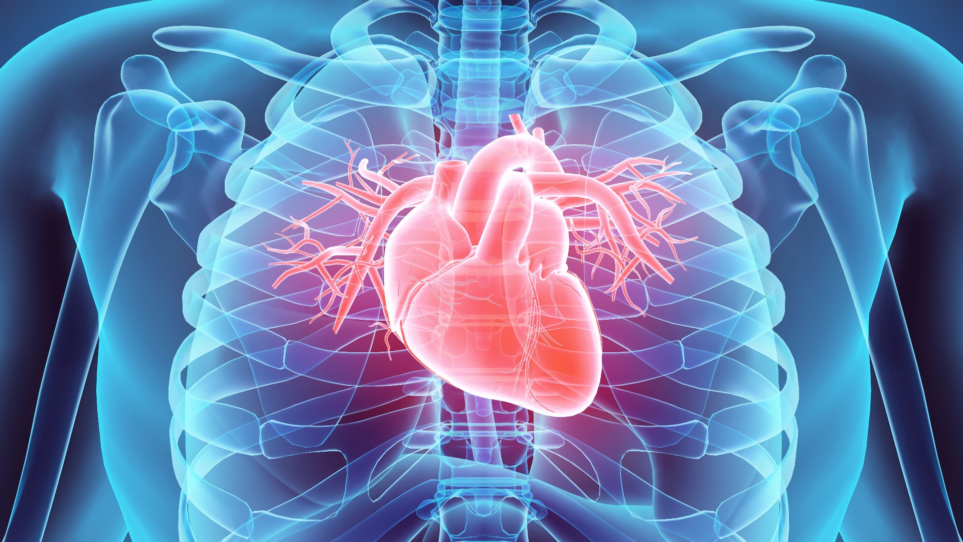 Unlike cardiac arrests, heart attacks are a circulation problem. When circulation is blocked or cut off, blood is no longer supplied to the heart.