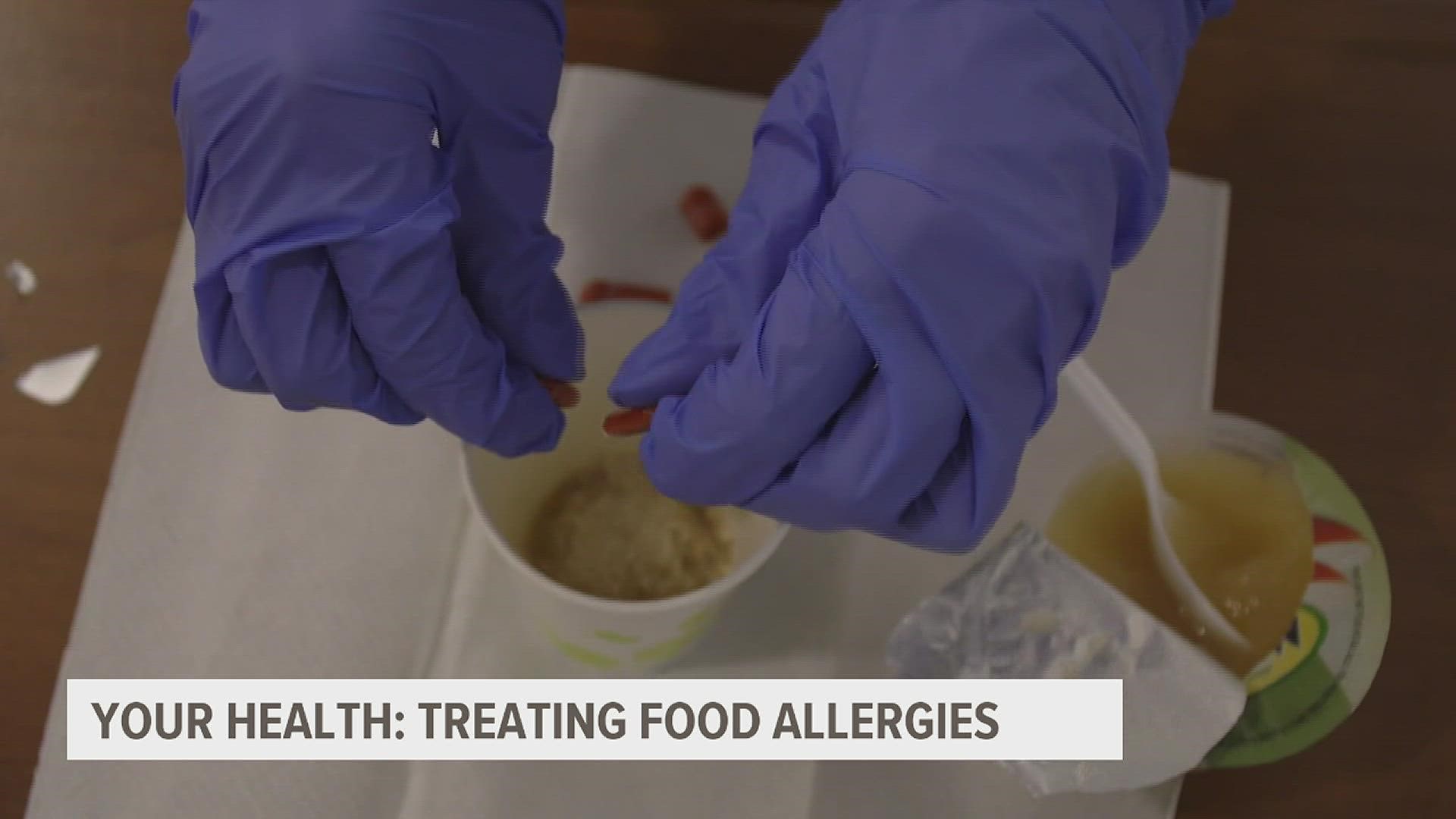 More than 32 million Americans, including kids, have food allergies. Now, new therapies have been approved, but researchers worry many people aren't aware.