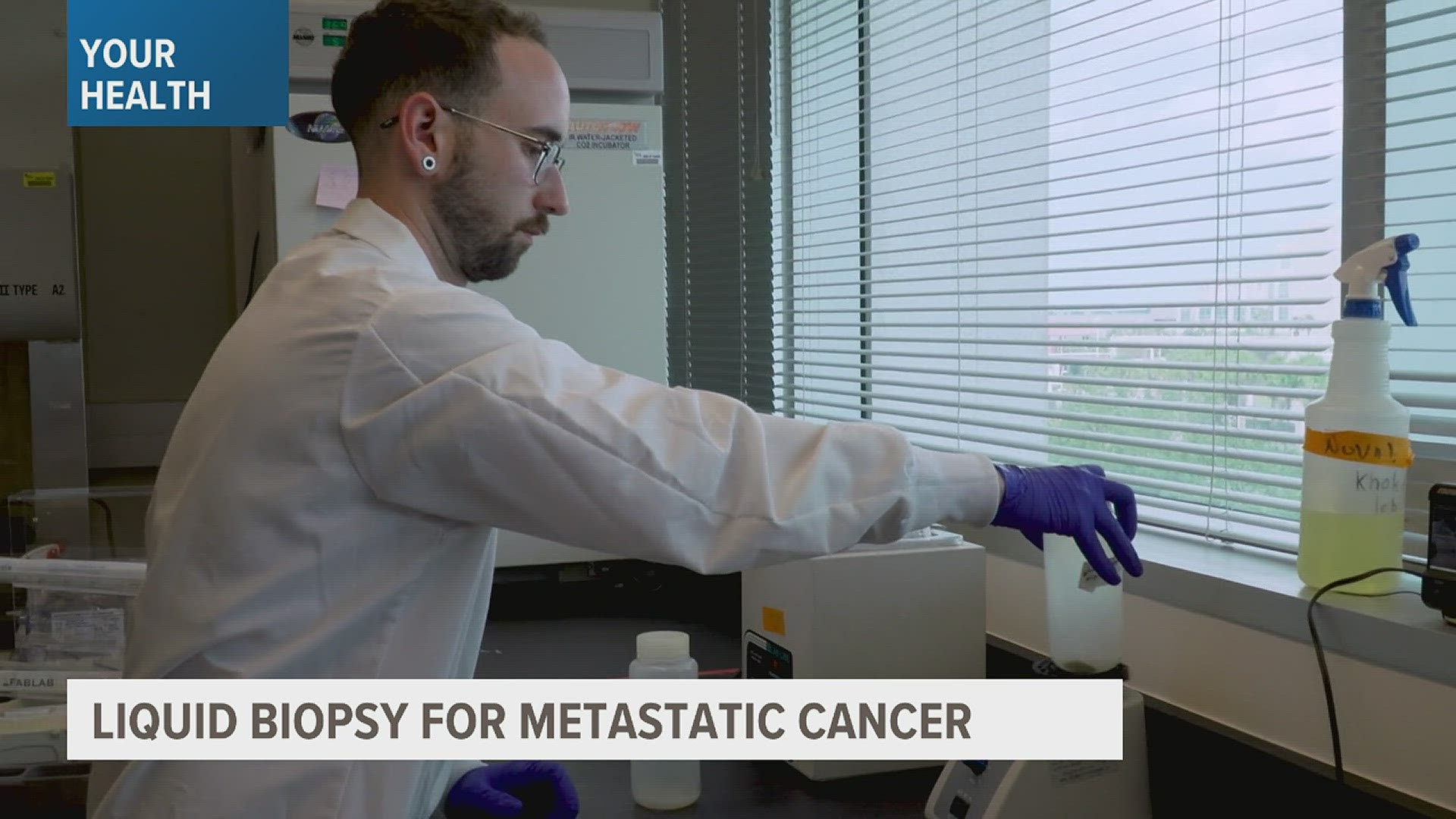 Florida scientists are seeking an alternative to tissue biopsies, and testing the efficacy and accuracy of fluid samples to detect metastasized cancer cells.