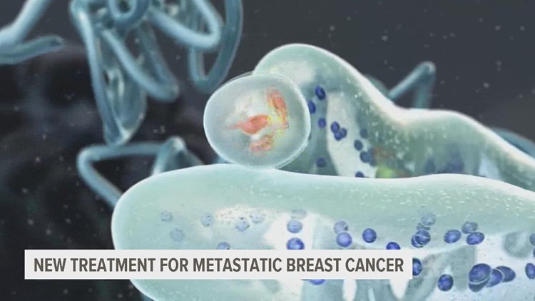 New FDA-approved therapy is keeping metastatic breast cancer at bay better than other treatments
