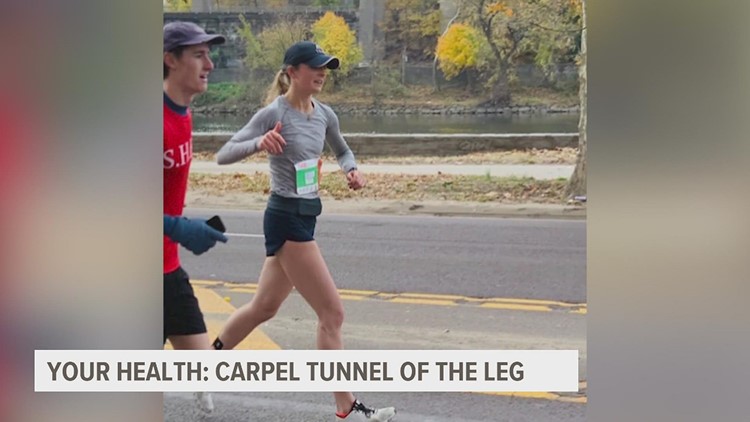 YOUR HEALTH: 'Carpal Tunnel' of the leg