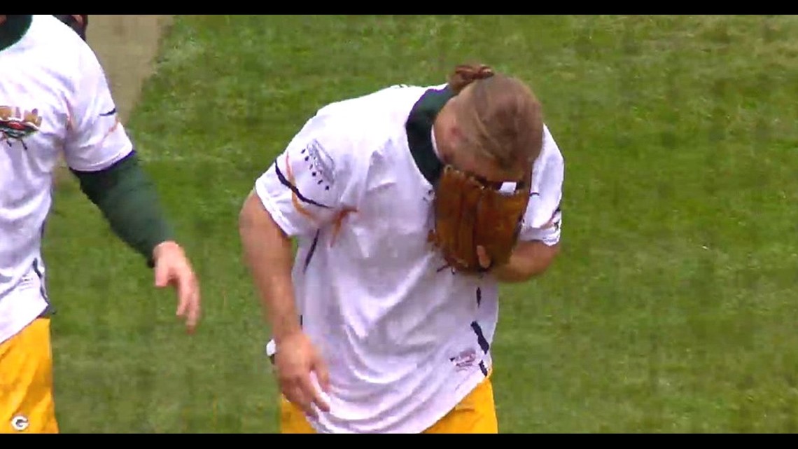 Green Bay Packers Clay Mathews takes line drive to face