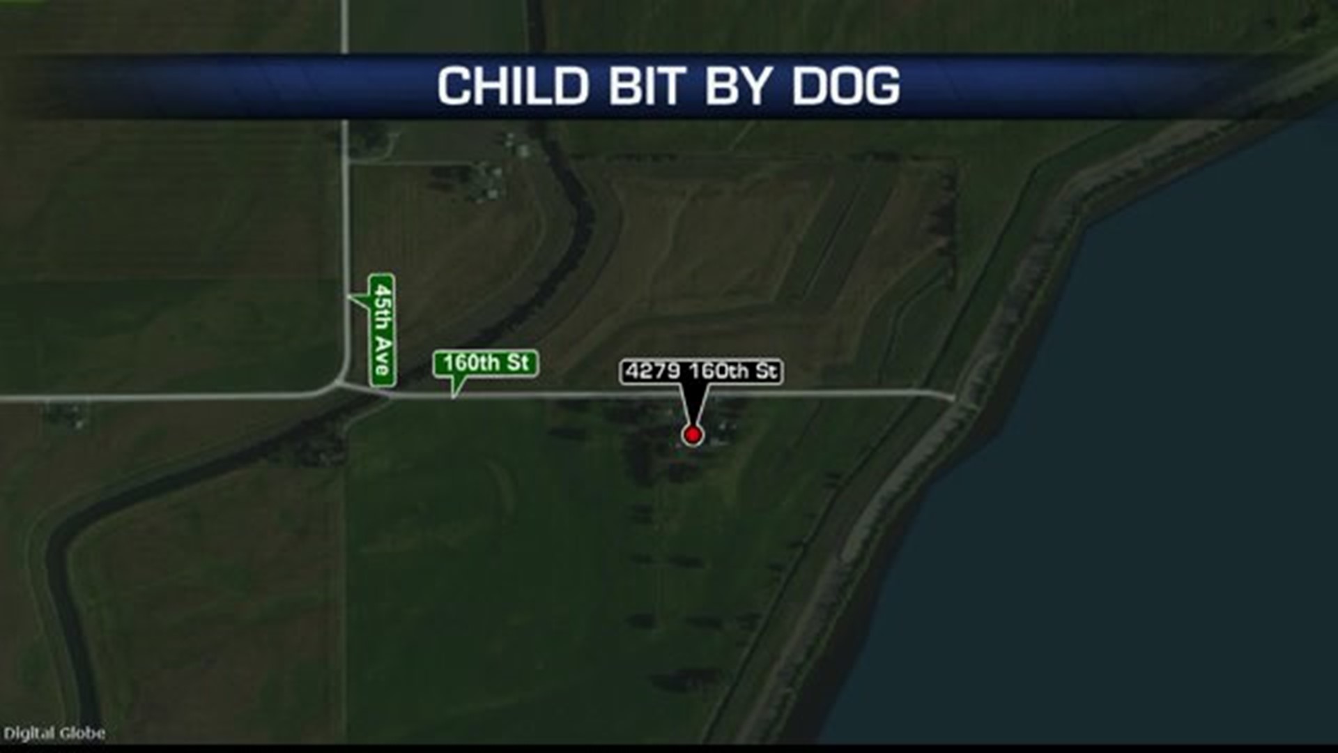 Child Bit By Dog