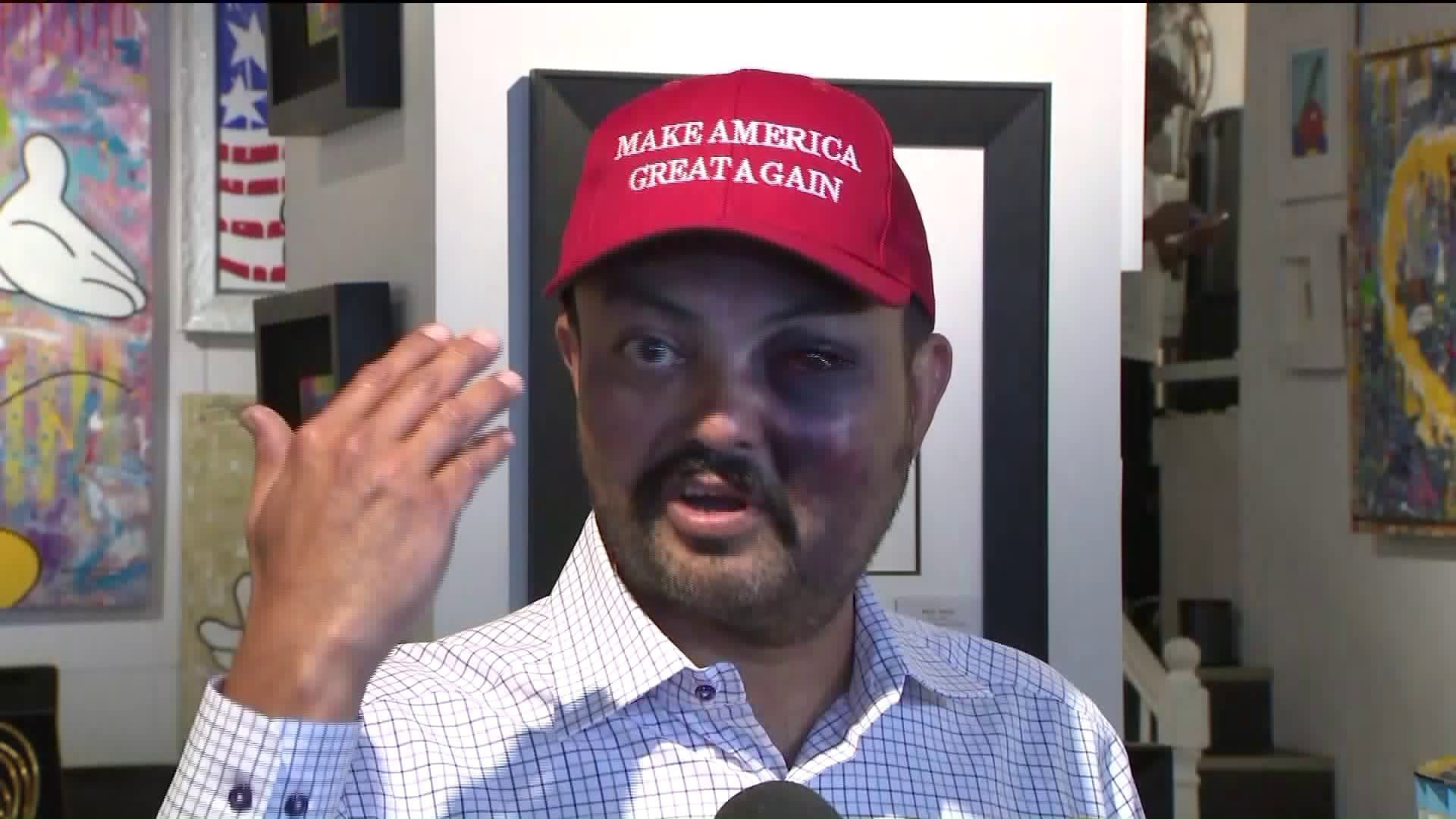 Man claims he was attacked by as many as 18 teens for wearing MAGA hat ...