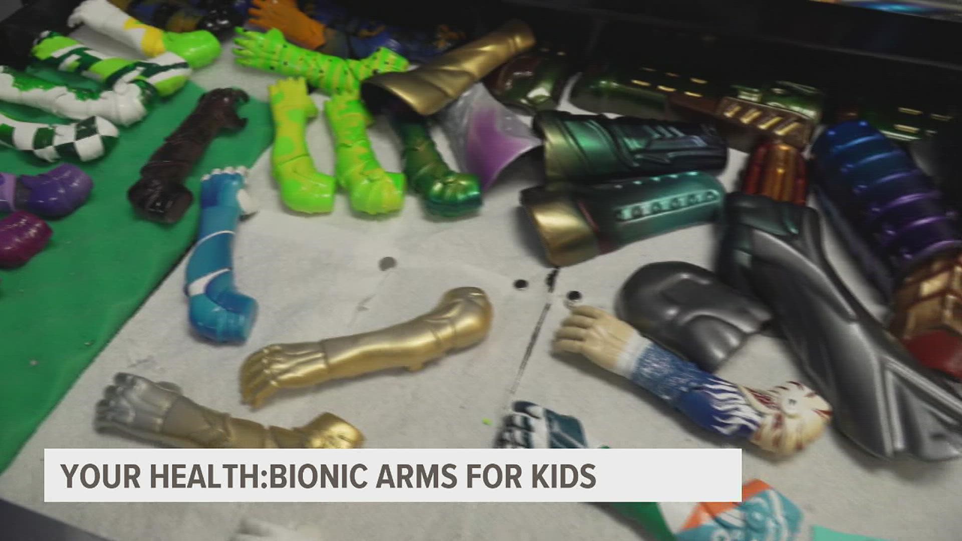 Researchers at the University of Central Florida developed bionic arms for kids who are born without. Those scientists developed a spin-off company called Limbi.