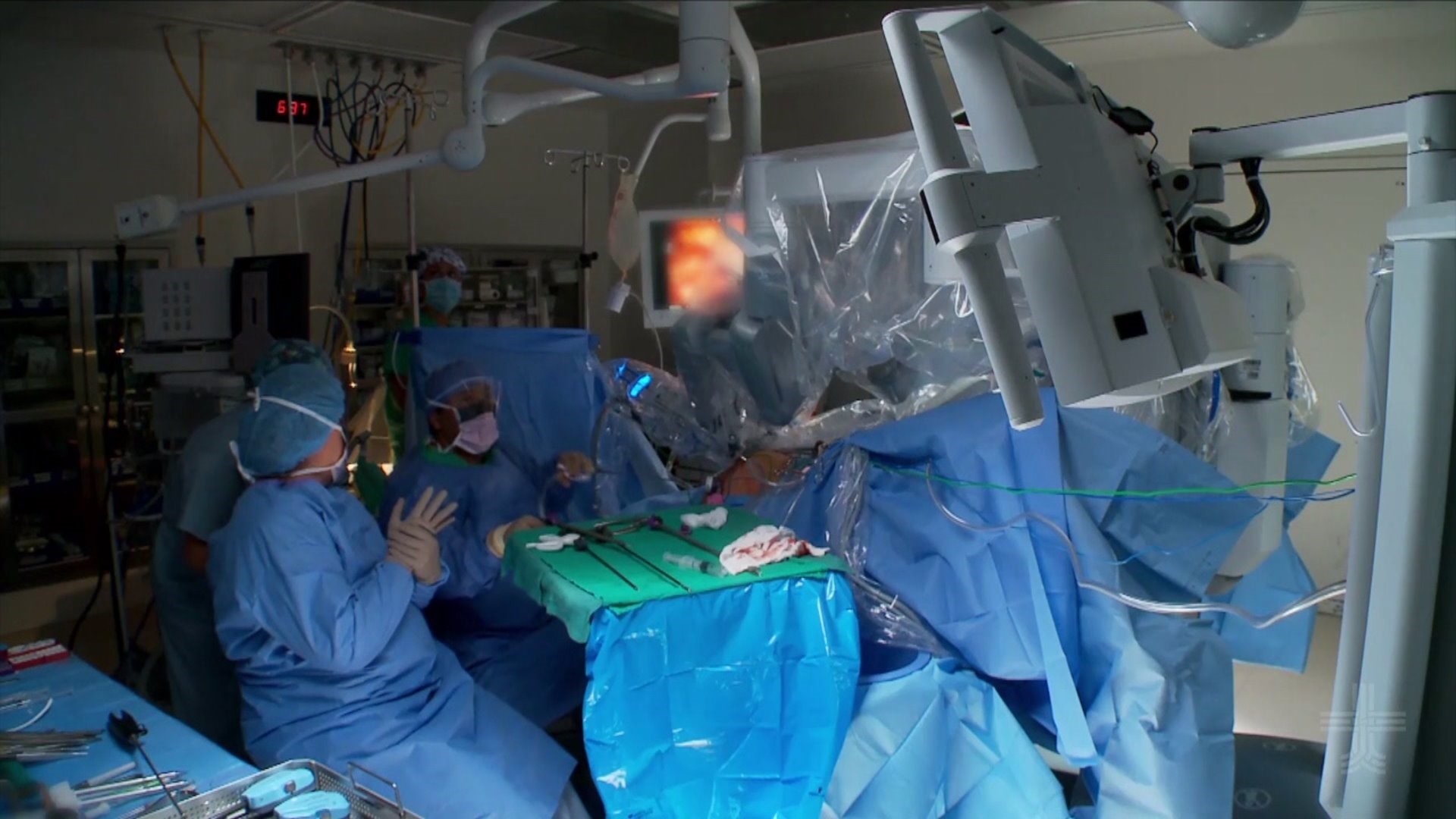 your-health-robotic-hernia-surgery-for-quicker-recoveries-wqad