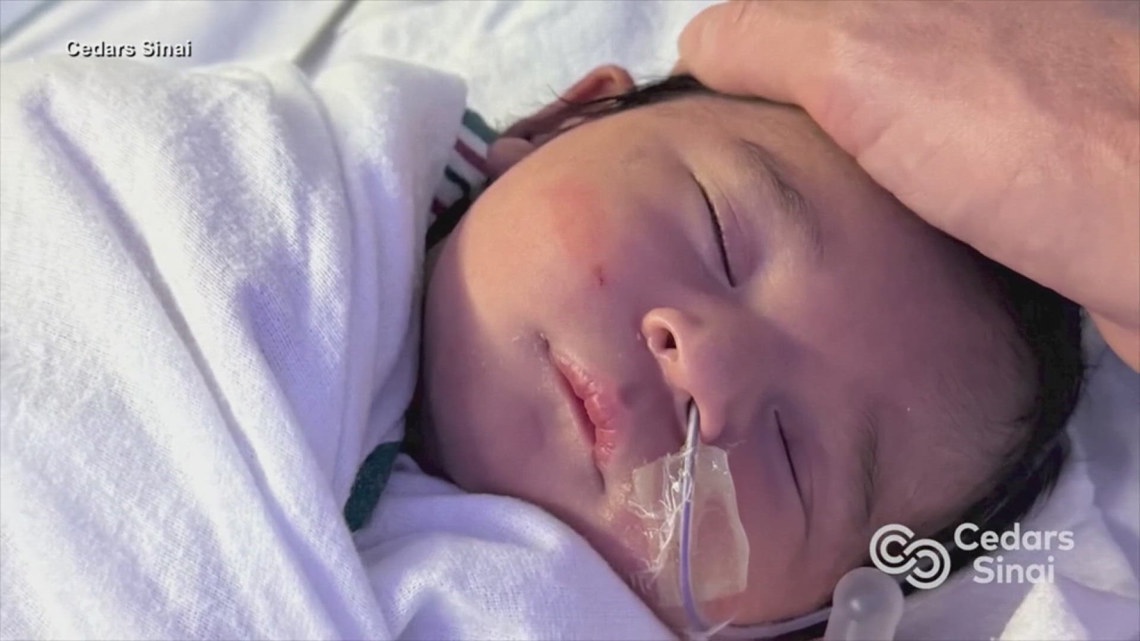 Doctors deliver baby while removing 22-pound tumor from mother, calling it a 'medical miracle'