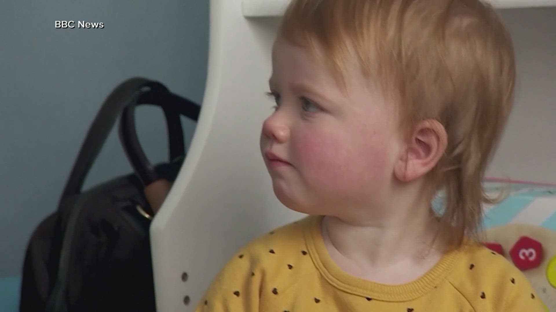 Just before baby Opal turned one she was given a targeted gene therapy infusion to help replace the bad DNA in her ears to restore her hearing.