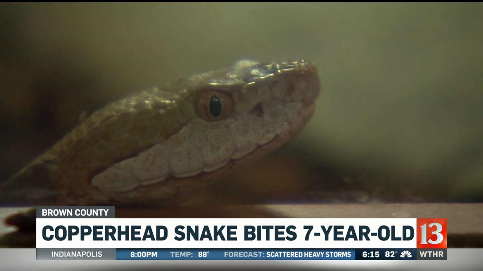 7yearold girl recovering from copperhead snake bite at Brown County State Park