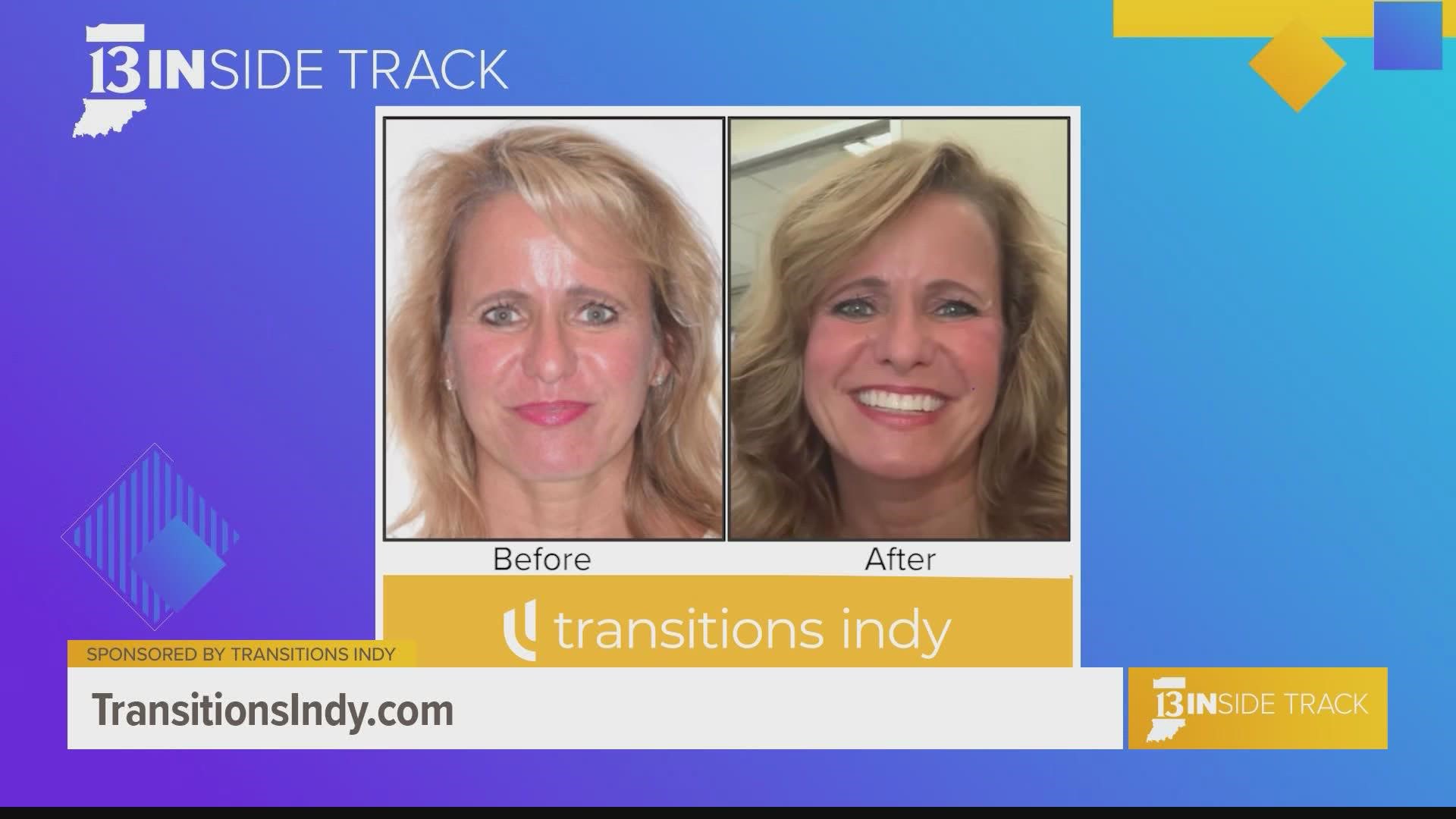 Transitions of Indiana believes hair restoration is not a "one size fits all" process.