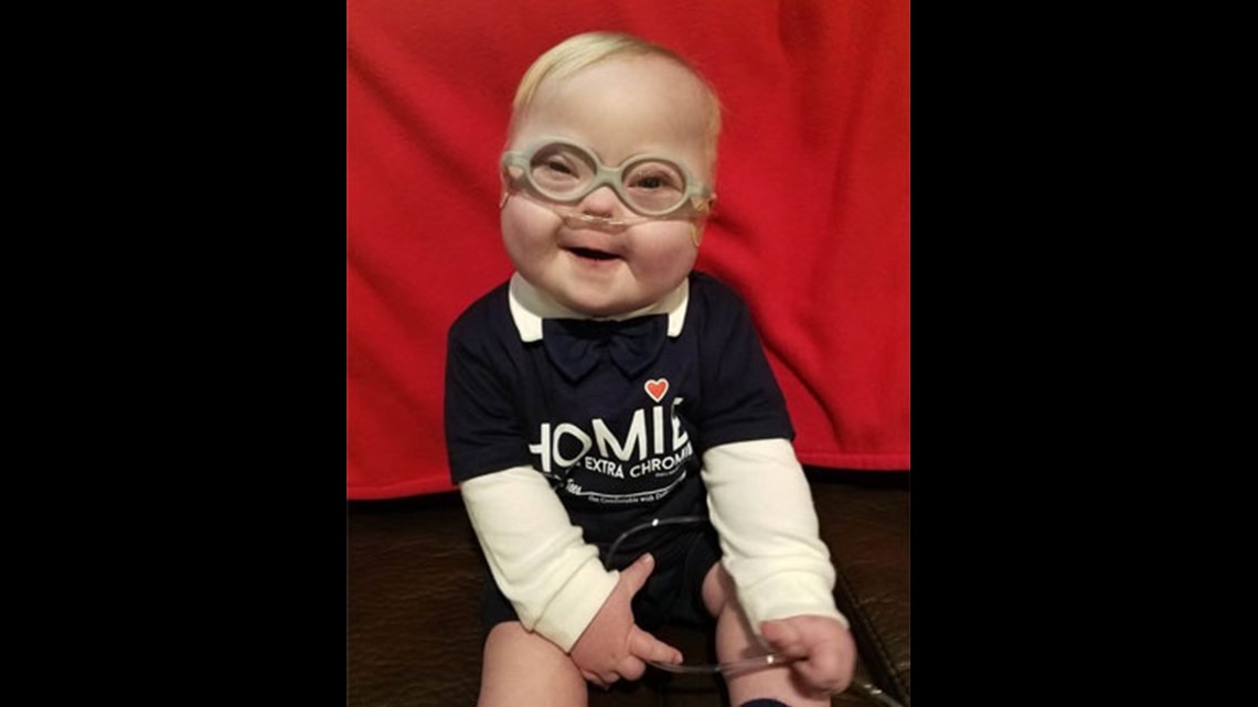 Down Syndrome video star Colton Murray passes away