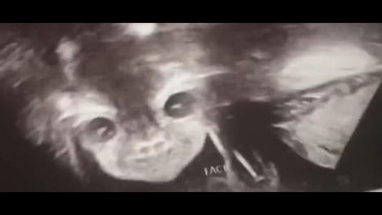 Mom is spooked, elated by 'demon' baby in ghostly ultrasound