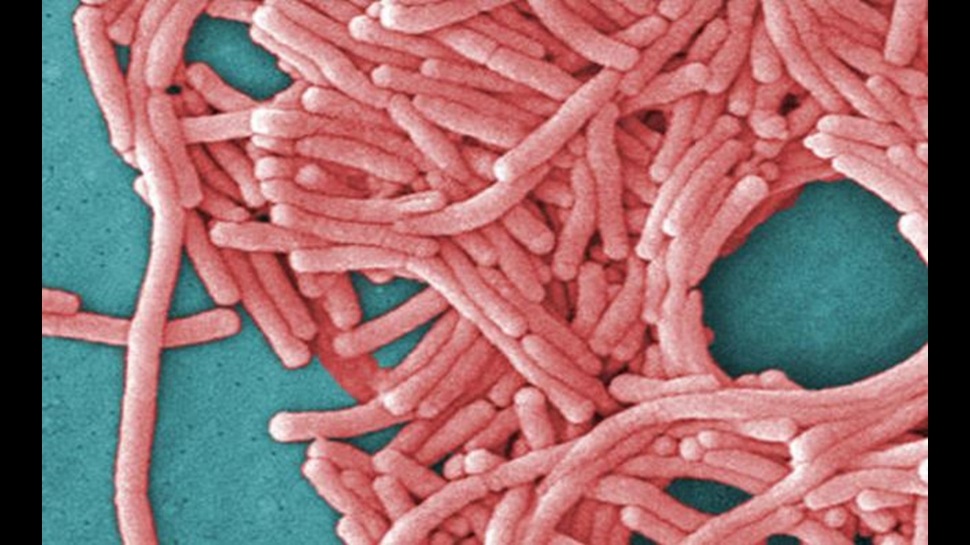 The Indianapolis Healthplex temporarily closed pending confirmation that the facility is free of legionella bacteria.