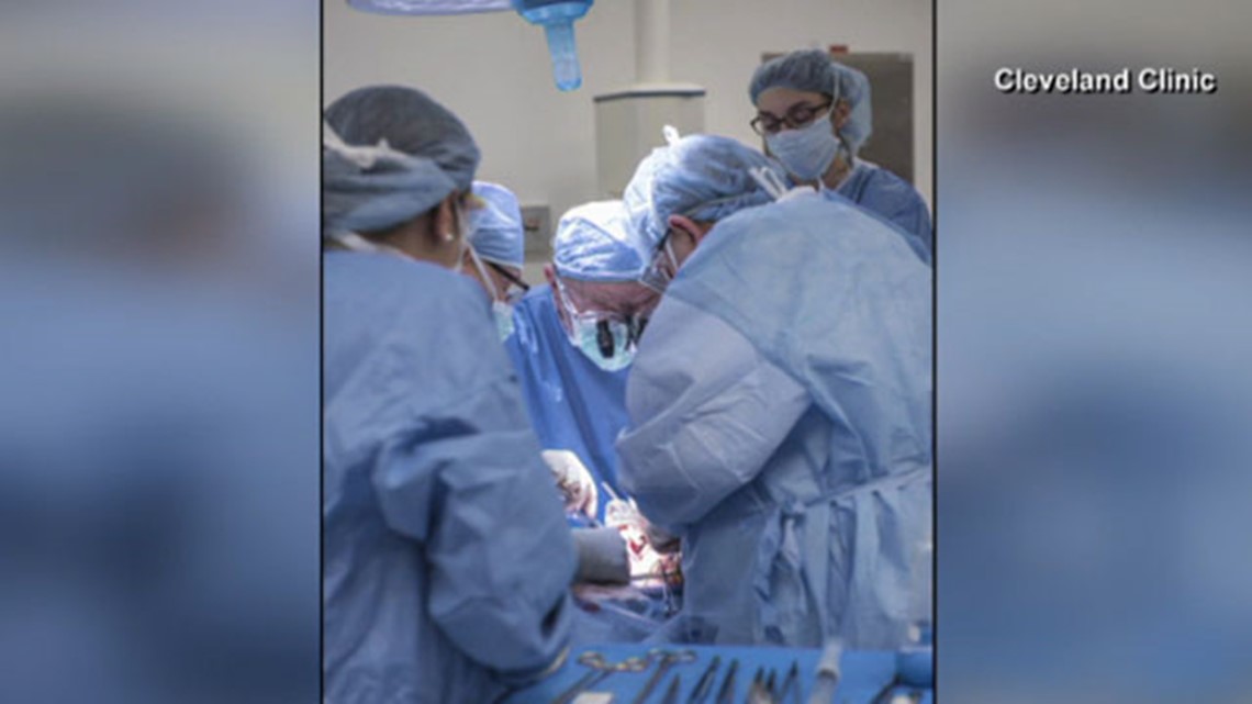 Cleveland Clinic performs nation's first uterus transplant(02)