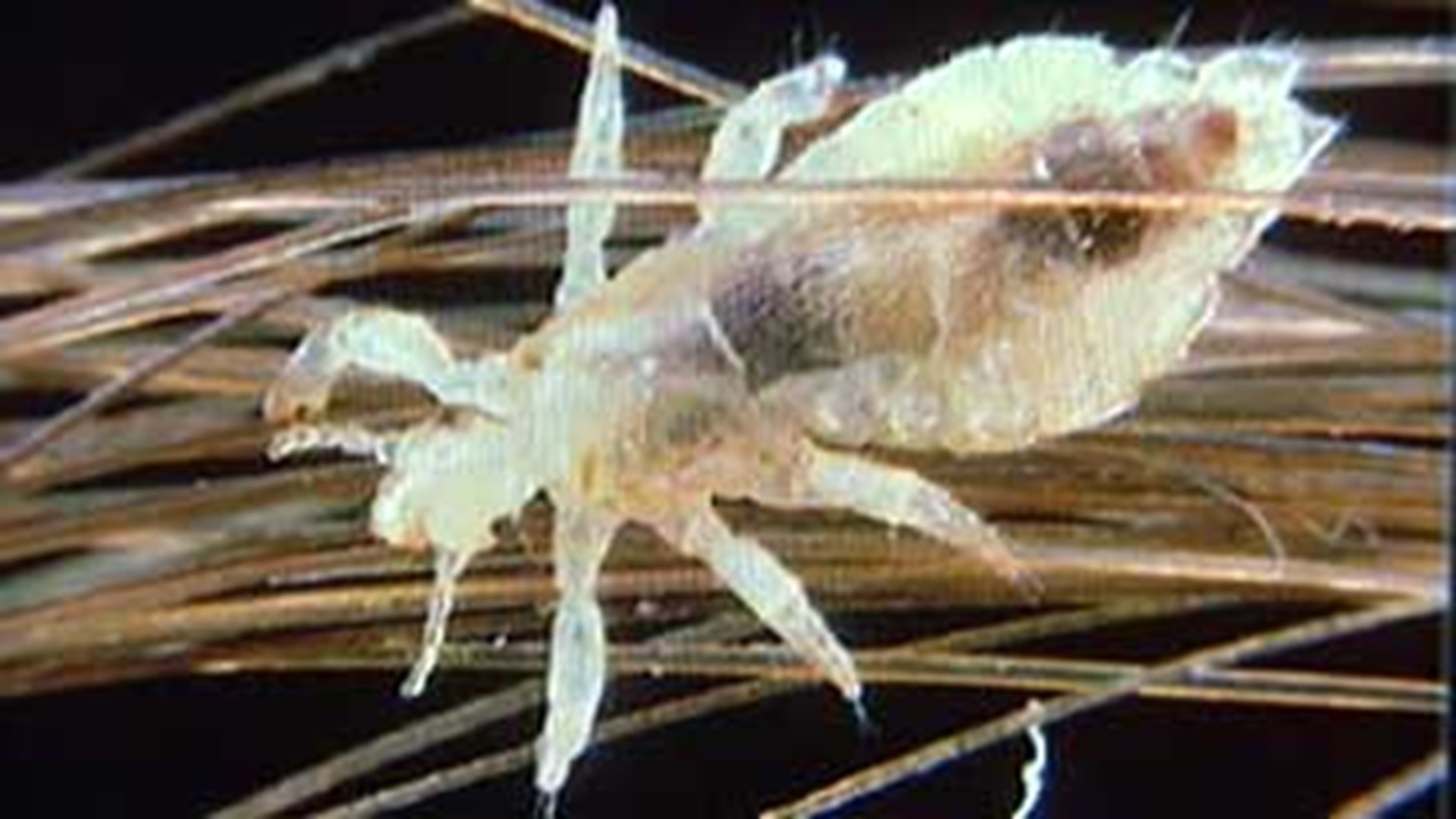 The Truth About Head Lice 