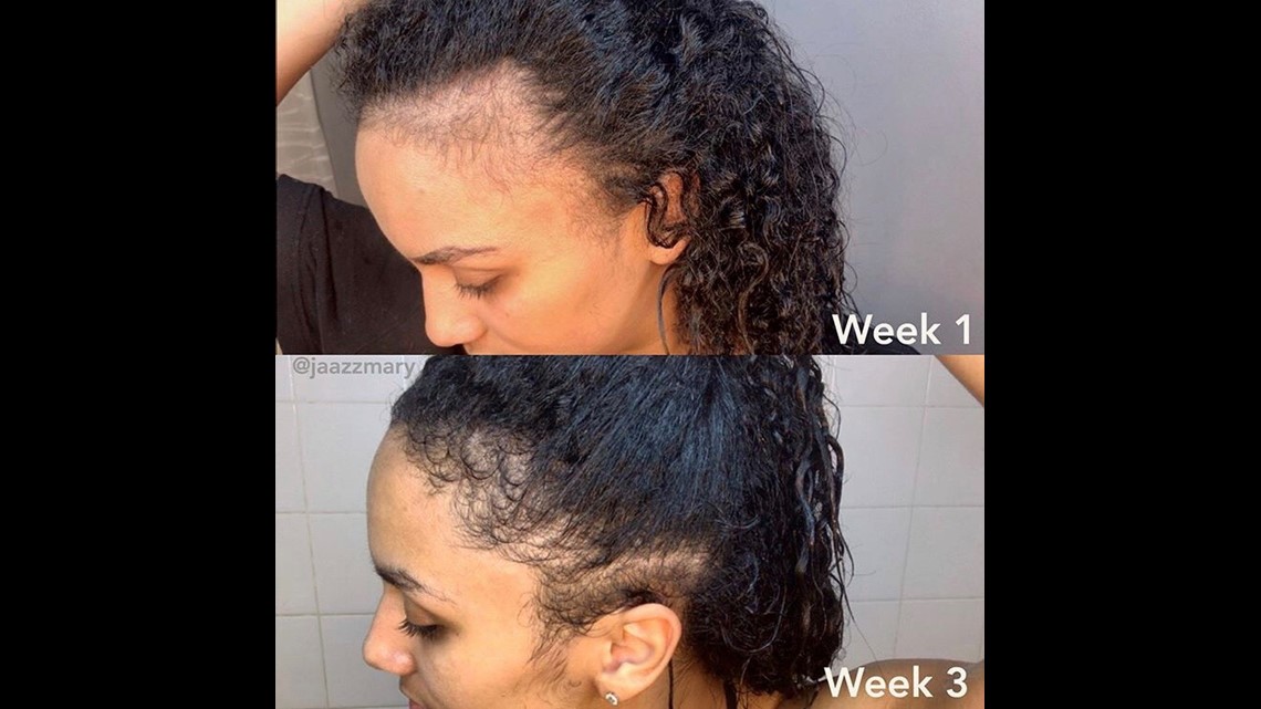 I Tried Rice Water for Hair Growth — Here's Why I Don't Like It