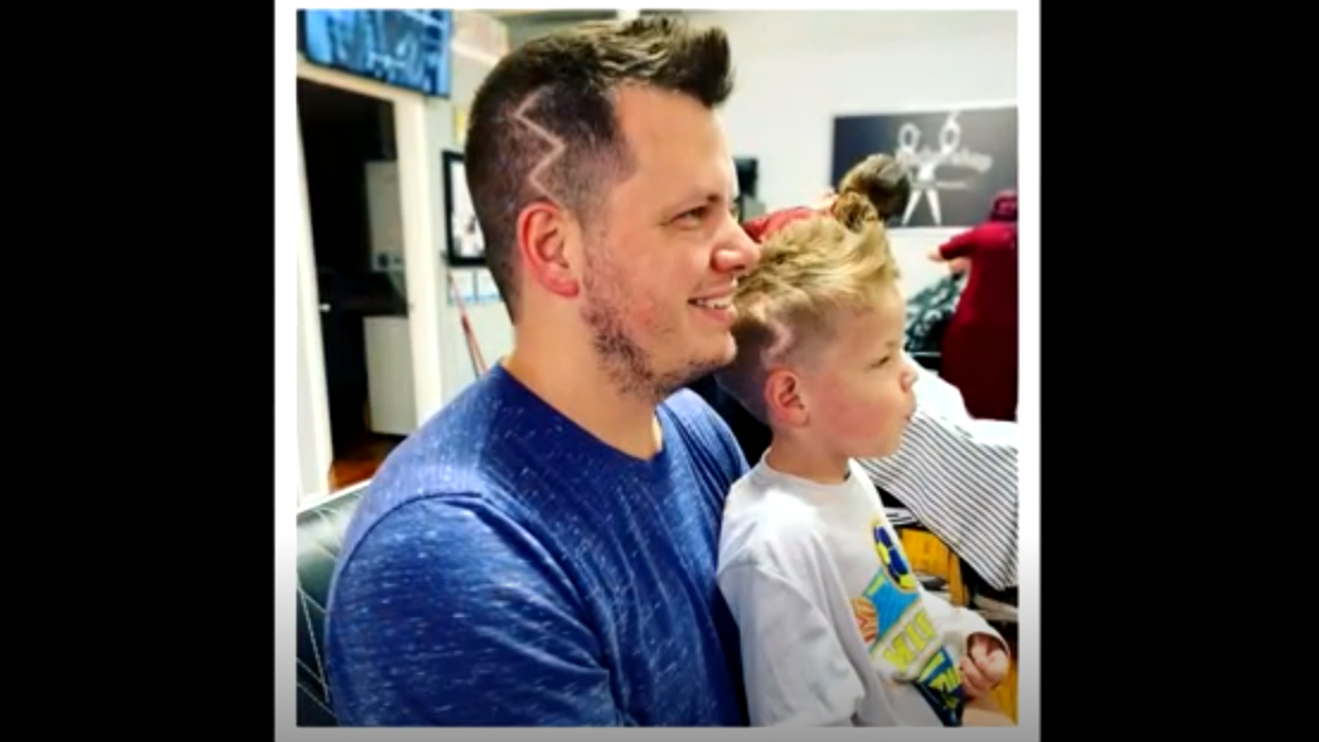 Five-year-old Hunter Tynes felt self-conscious about his surgery scars, so his dad got a special haircut to match.