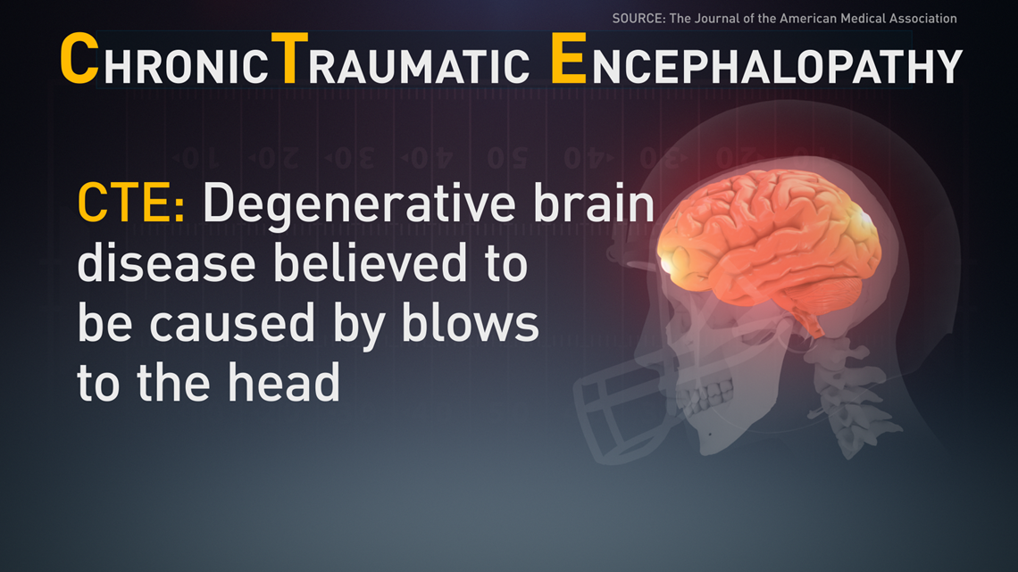 CTE Risk Doubles After 3 Years of Playing Football