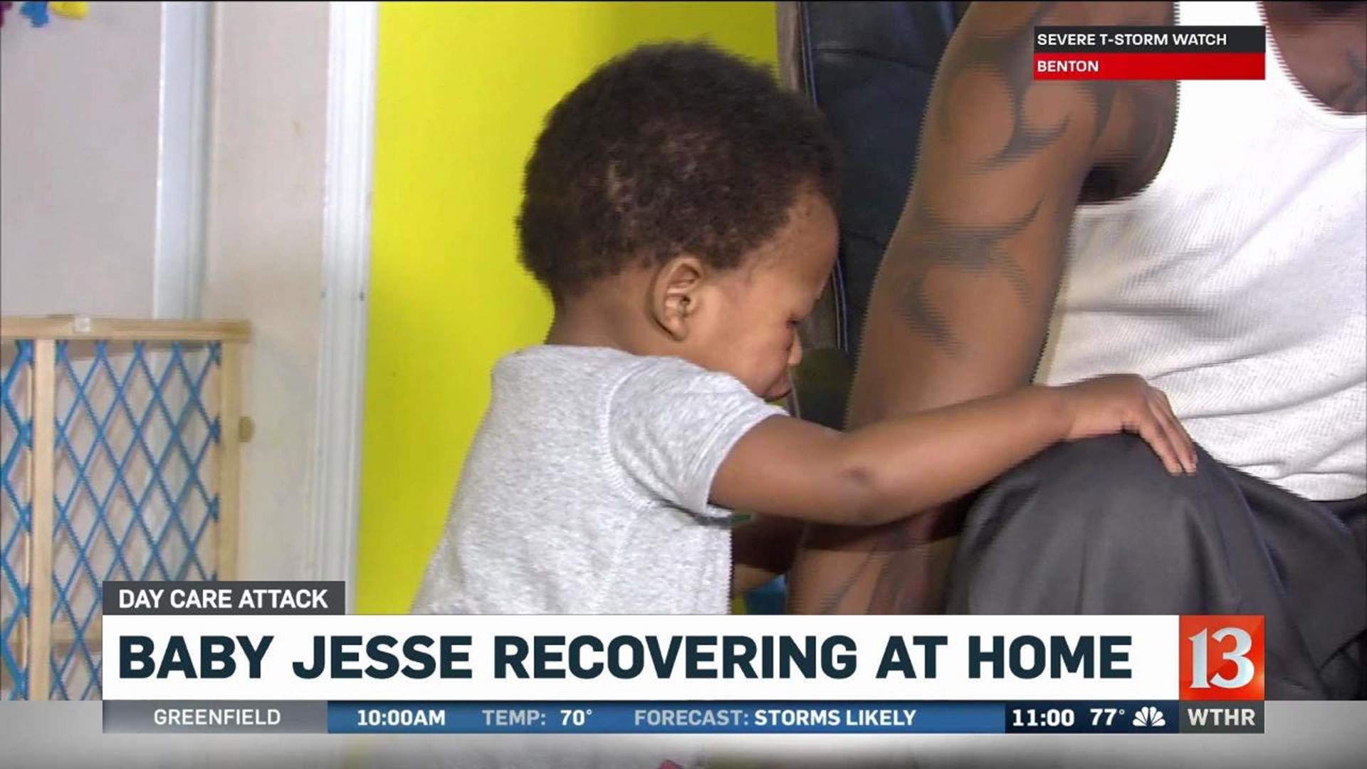 Baby Jesse recovering at home