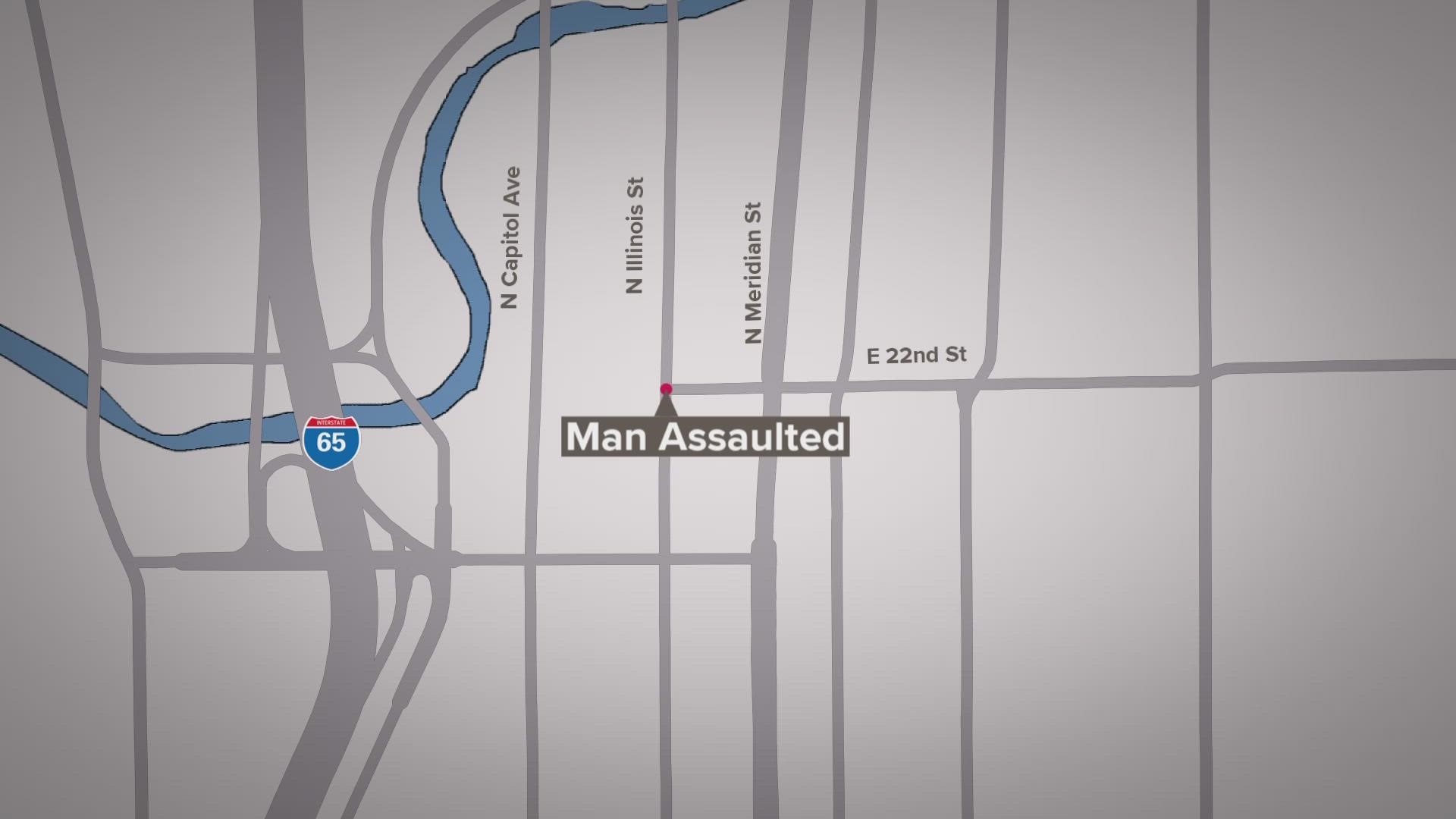 The victim in a Feb. 20 assault died on Sunday, IMPD said.