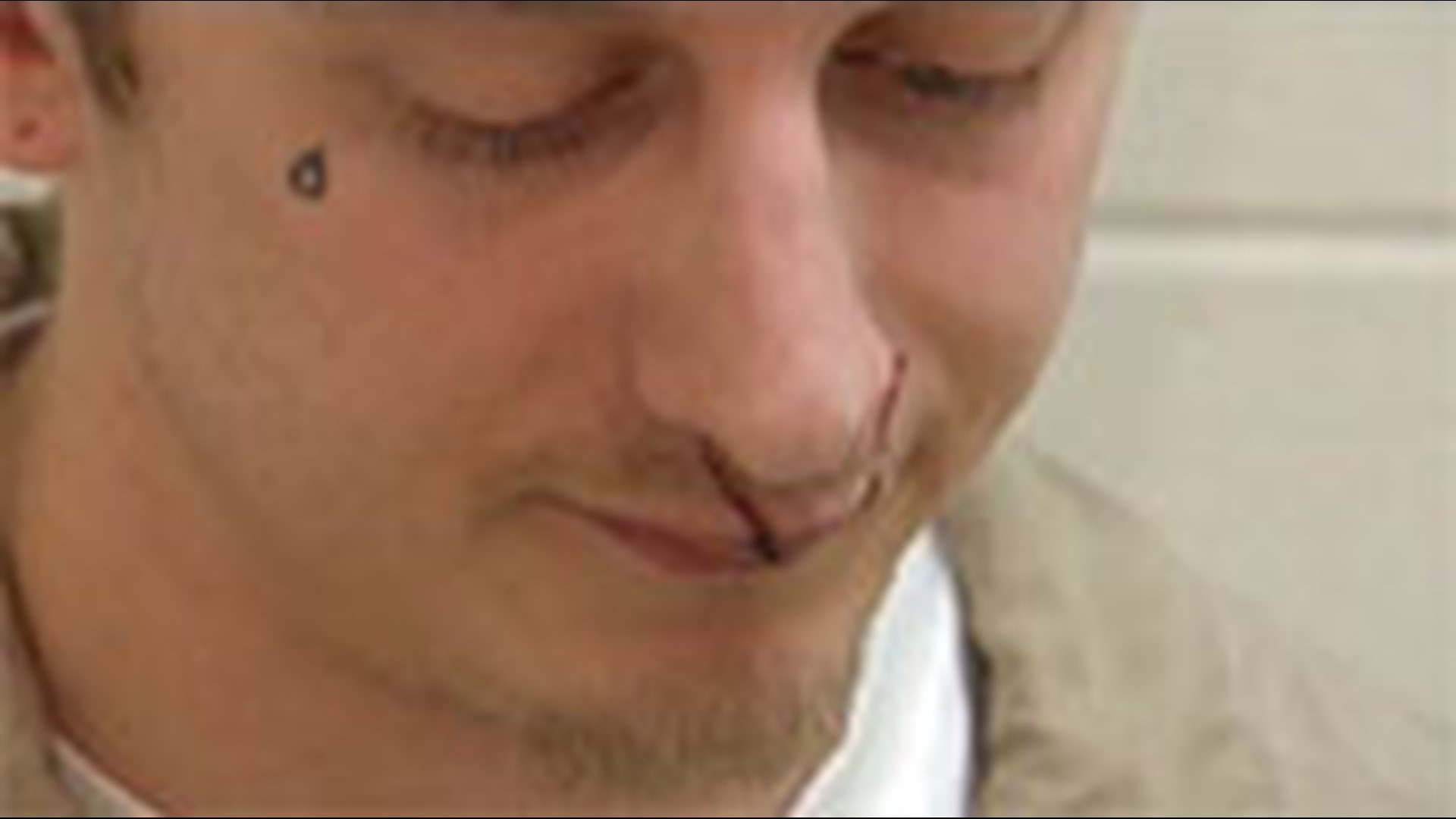 Inmate says medical care delayed after dog bite